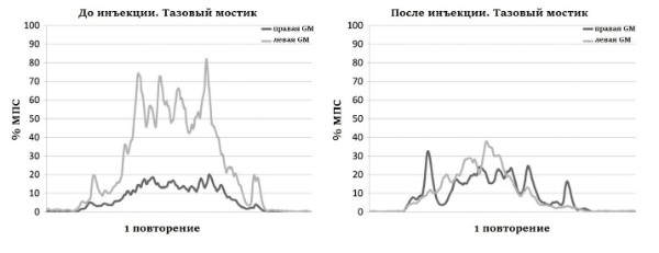 Молчание ягодичных мышц рис 1.jpg